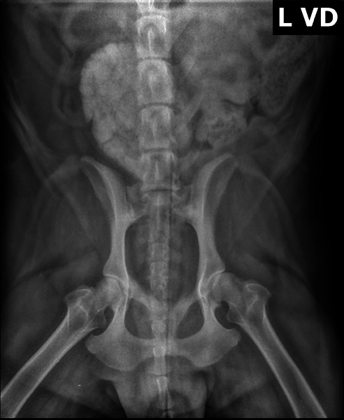 X-ray 1